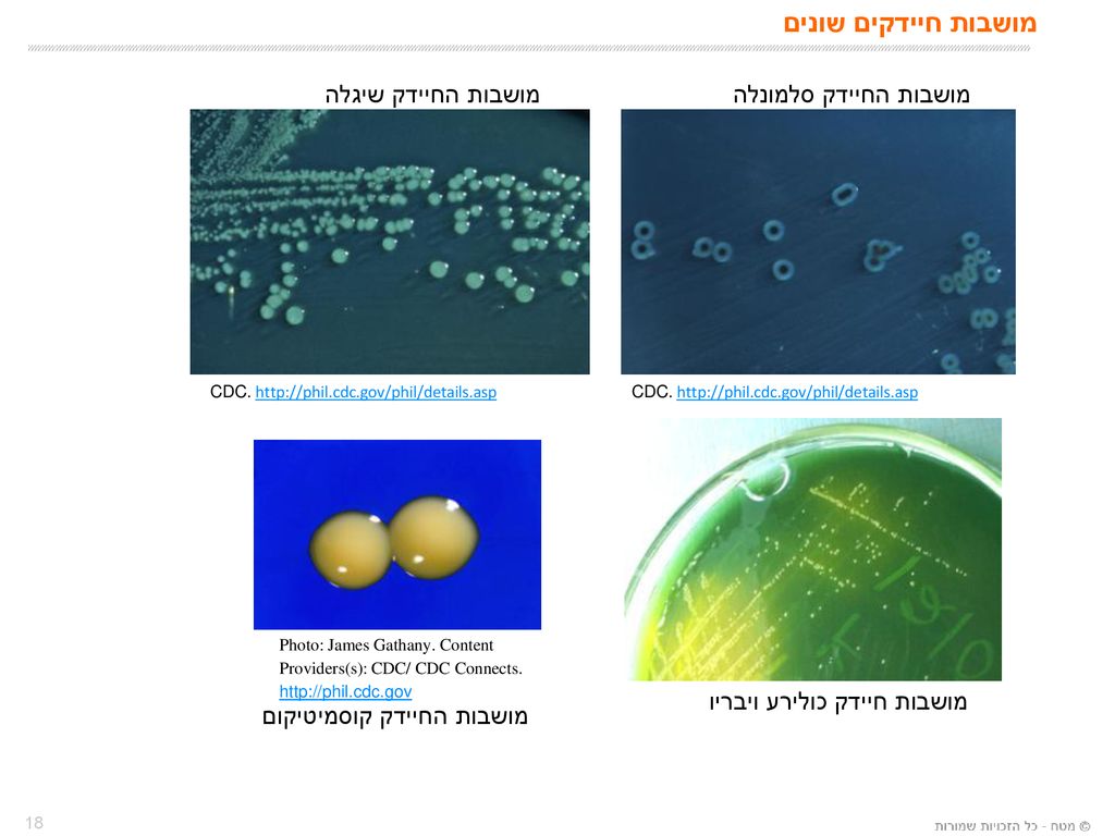 מושבות חיידקים שונים מושבות החיידק שיגלה מושבות החיידק סלמונלה